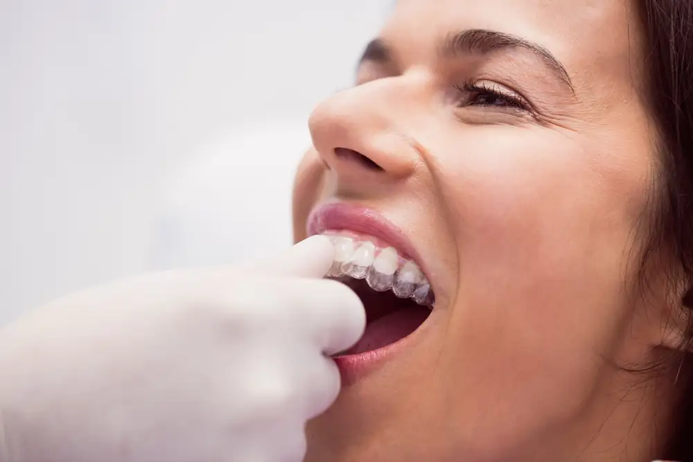 Dentista ajustando o alinhador transparente na paciente durante a consulta